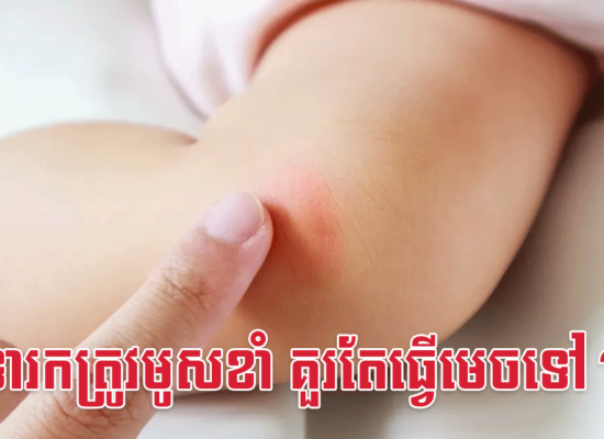 ទារកត្រូវមូសខាំ គួរតែធ្វើមេចទៅ?