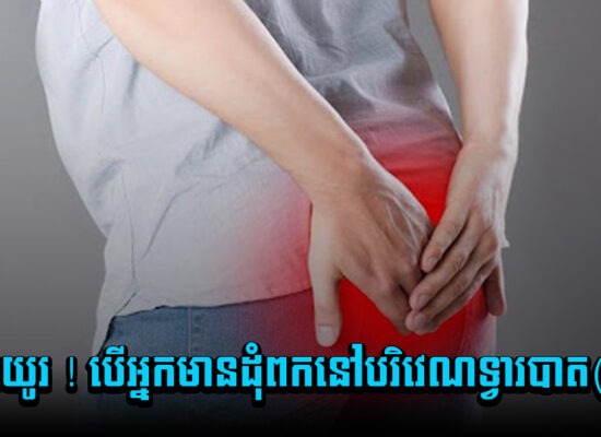 កុំទុកយូរ ! បើអ្នកមានដុំពកនៅបរិវេណទ្វារបាត(គូថ)