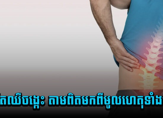 ចេះតែឈឺចង្កេះ តាមពិតមកពីមូលហេតុទាំង ១០យ៉ាងនេះ