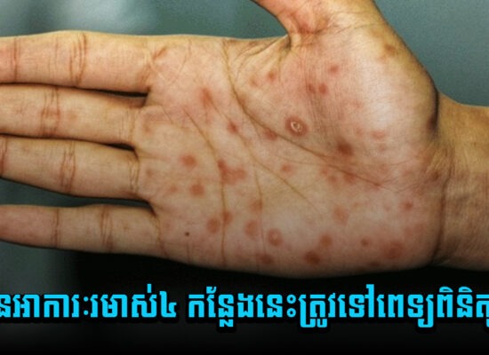 ឆាប់ទៅពេទ្យ ! បើមានអាការៈរមាស់៤កន្លែងនេះ 