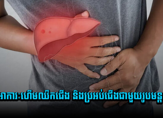មិនបានទេ ! ជំងឺរលាកថ្លើមរ៉ាំរ៉ៃអាចក្លាយជាមហារីកបានដែរ