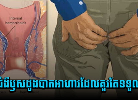 ការពារប្រសើរជាងព្យាបាល ! អ្នកកើតជំងឺឫសដូងបាត មកដឹងពីប្រភេទអាហារដែលគួរតែទទួលទាន