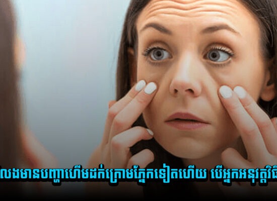 អ្នកនឹងលែងមានបញ្ហាហើមដក់ក្រោមភ្នែកទៀតហើយ បើអ្នកអនុវត្តវិធីទាំងនេះ