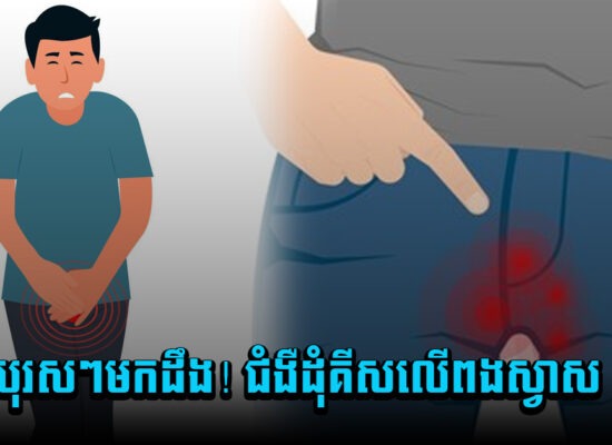 បុរសៗមកដឹងឱ្យហើយ ! ជំងឺដុំគីសលើពងស្វាស